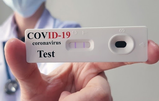 نوفل عميرة : وزارة الصحة لم تستشر أهل الاختصاص عند تحديد سعر التحاليل السريعة